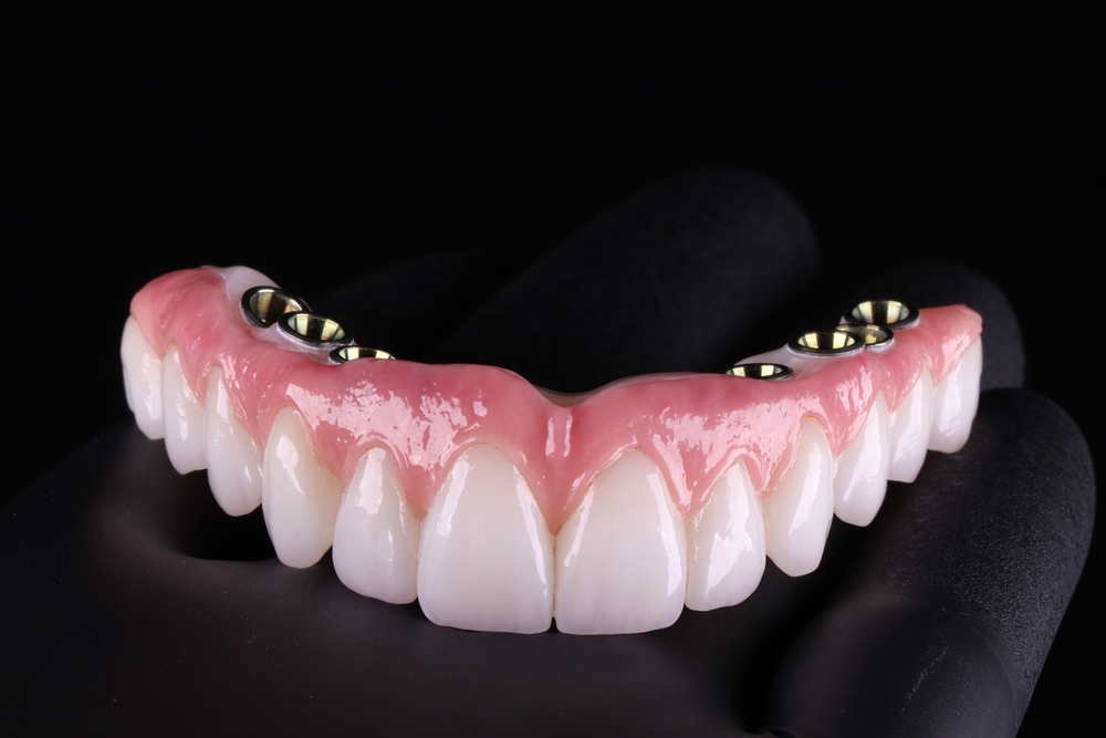 Folheto promocional da All-On Implants da Pelican Dental Care em Vero Beach, Flórida. Inclui preços para uma arcada e para ambas as arcadas, com taxas exclusivas para membros e detalhes abrangentes do pacote.